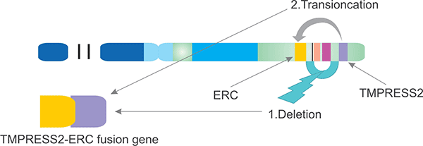 TMPRESS2-ERG融合機制(21號染色體)