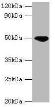 CSB-PA010990ESR1HU