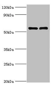 CSB-PA011670ESR1HU