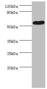 CSB-PA018846ESR2HU