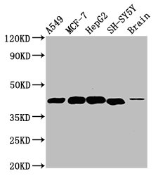 CSB-PA006945LA01HU