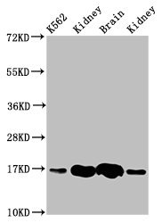 CSB-PA010156LA01HU WB