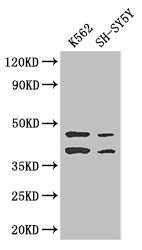 CSB-PA001499LA01HU