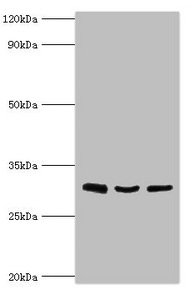 CSB-PA012376ESR2HU