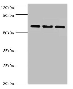 CSB-PA822717ESR2HU