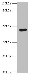 CSB-PA863932ESR2HU