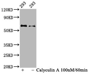 CSB-RA001553A473phHU-WB