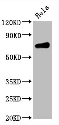 CSB-RA004965A0HU