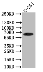 CSB-RA051685A0HU