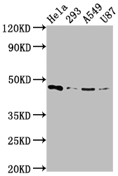 CSB-RA225579A0HU