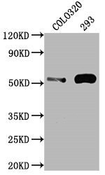 CSB-RA236796A0HU