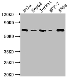 CSB-RA593846A0HU