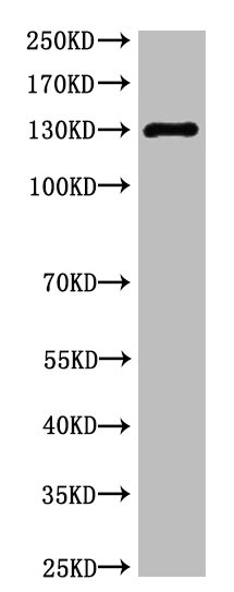 CSB-MA000326