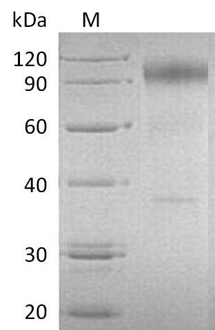 CSB-AP004371HU