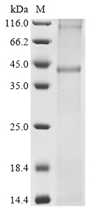 CSB-CF4163HU