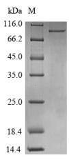 CSB-EP006621HU-SDS