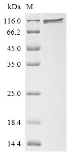 CSB-EP006938HU