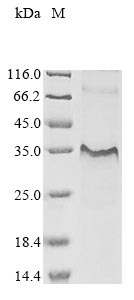 CSB-EP011670HU1