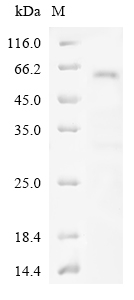 CSB-EP017713HU