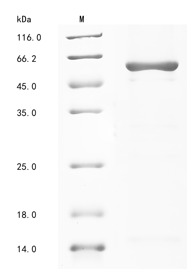 CSB-EP018072HU1