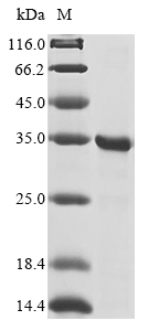 CSB-EP863932HU1b1