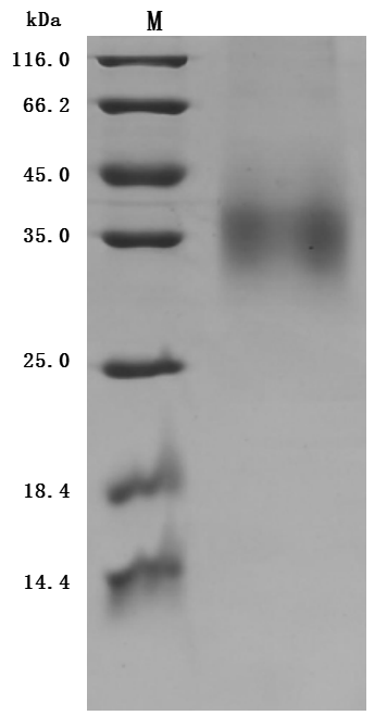 CSB-MP009316HU1 SDS-PAGE