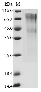 CSB-MP009705HU(M) SDS-PAGE