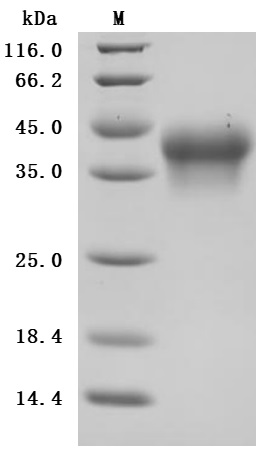 CSB-MP011649HU3 SDS-PAGE