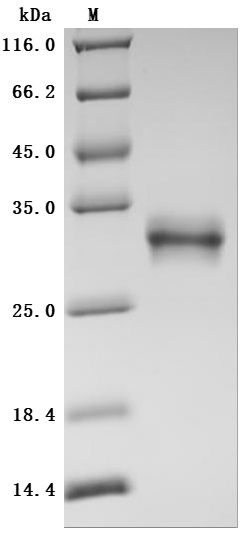 CSB-MP017260HU1 SDS-PAGE