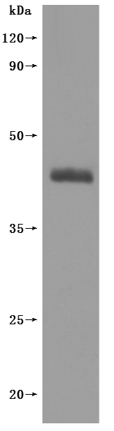 CSB-MP005678HU WB