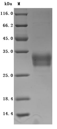 CSB-MP855470HUh7 SDS-PAGE