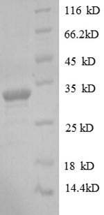 CSB-EP006945HU