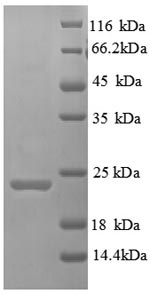 CSB-EP010145HU