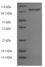 CSB-EP026193HU