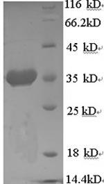 CSB-EP010827HU1