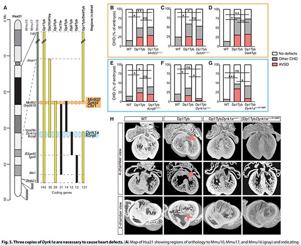 Three copies of Dyrk 1a are necessary to cause heart defects.