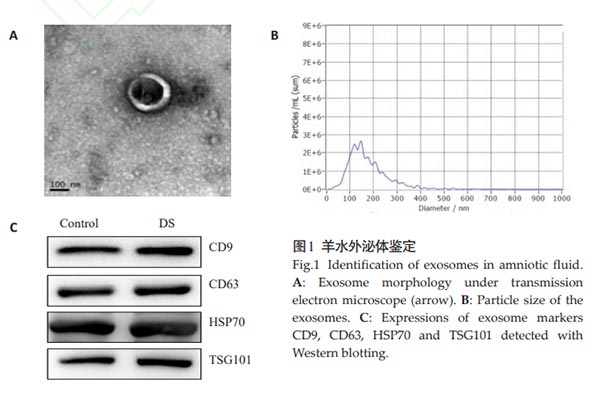 羊水外泌體鑒定