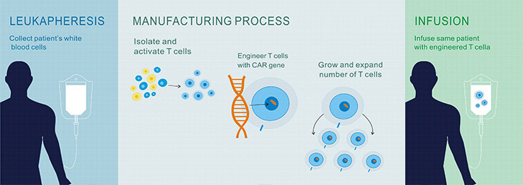 CAR-T細(xì)胞治療的過程