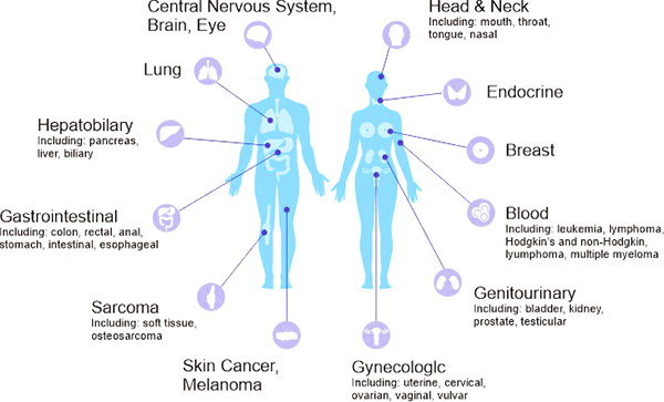 癌癥在人體中的分布