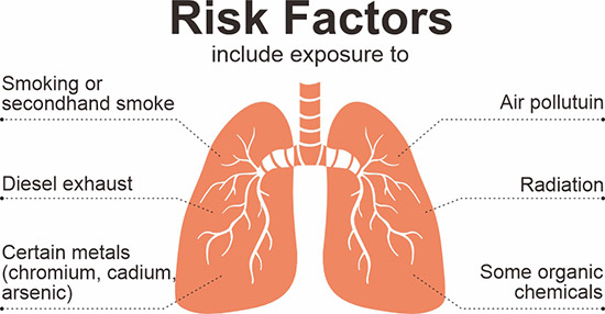獲得肺癌的危險(xiǎn)因素