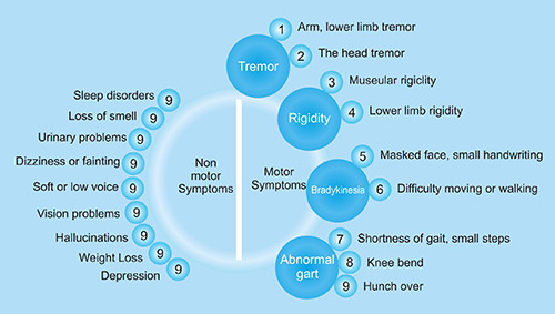 帕金森病的癥狀